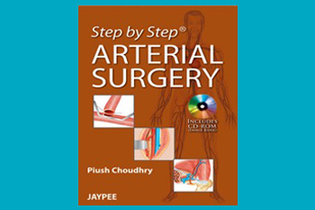 Step by Step Arterial Surgery